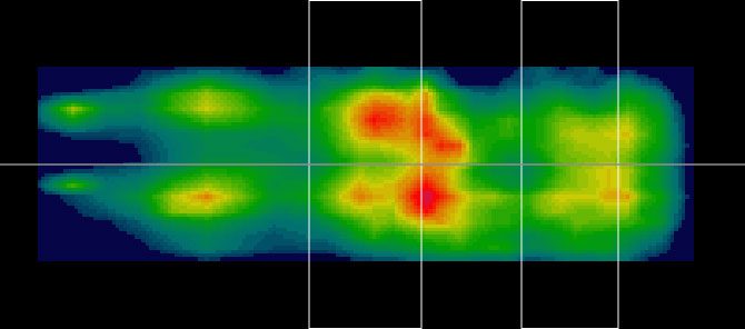 meting, druk, advies, bed, kalkman, bodegraven, beddenspeciaalzaak, beddenwinkel,