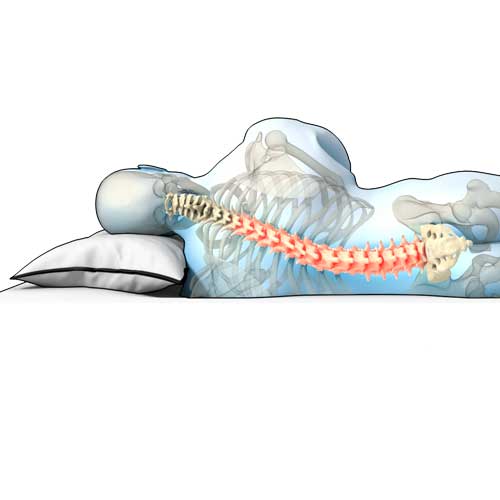 rugpijn, lighouding, comfort, advies, kalkman, beddenspecialist, beddenspeciaalzaak, bodegraven,