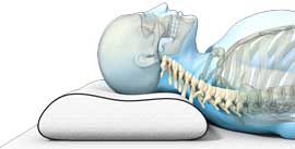 rugliging, juist, hoofdkussen, nekpijn, kalkman, bodegraven, beddenspeciaalzaak, beddenspecialist,