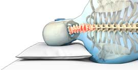 zijliging, onjuist, dun, te laag, hoofdkussen, nekpijn, kalkman, bodegraven, beddenspeciaalzaak, beddenspecialist,